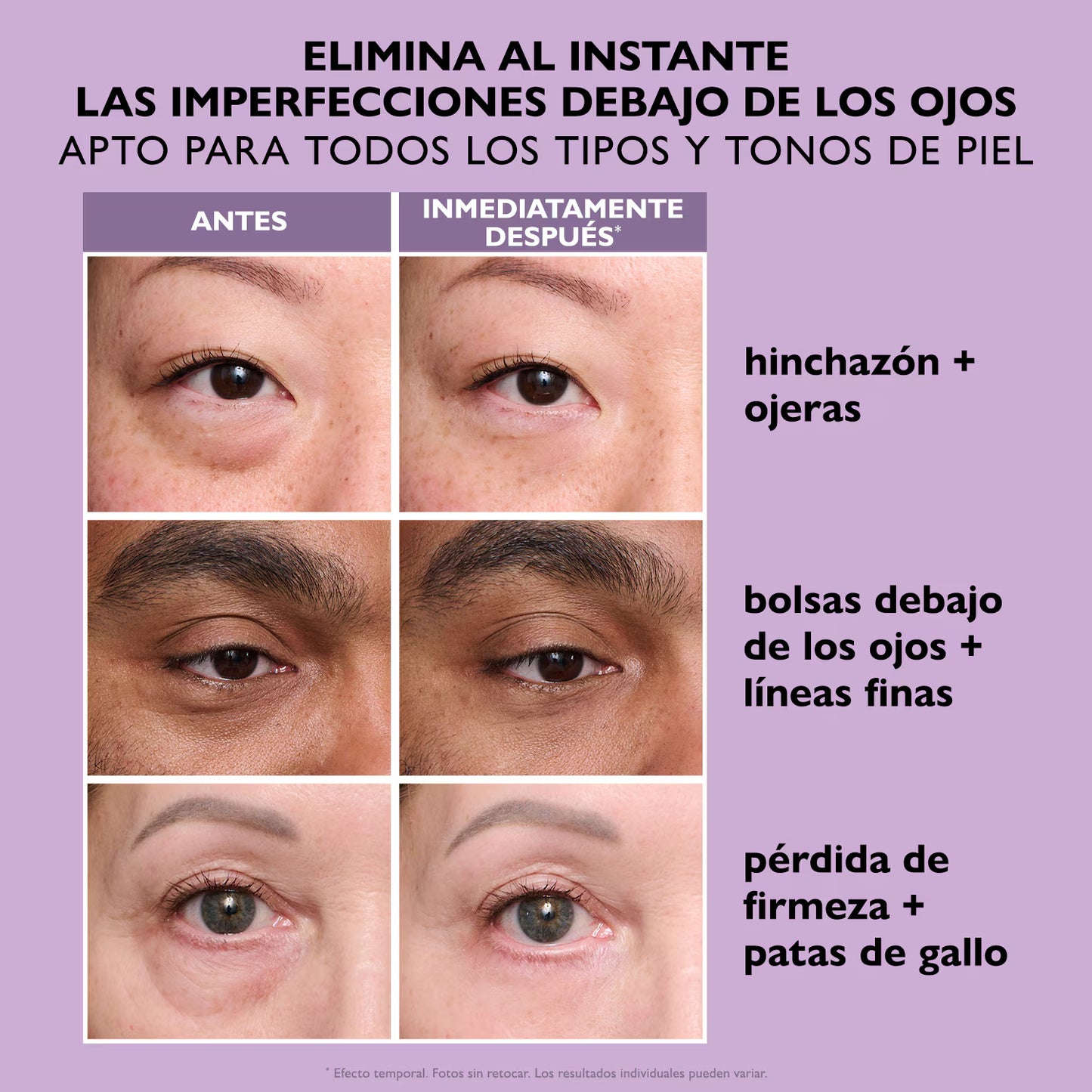 Pether Thomas Eye Serum – Reducción Instantánea de Bolsas y Ojeras